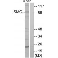 TLR4 Polyclonal Antibody