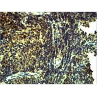 TLR8 Polyclonal Antibody