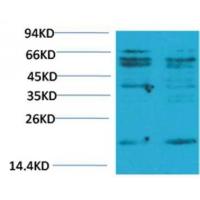 TNF α Polyclonal Antibody