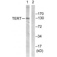 TERT Polyclonal Antibody