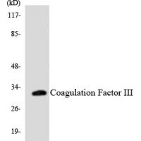 TF Polyclonal Antibody