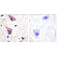 TGFβ RII Polyclonal Antibody