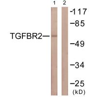 TGFβ RII Polyclonal Antibody