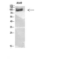 TGFβ RIII Polyclonal Antibody