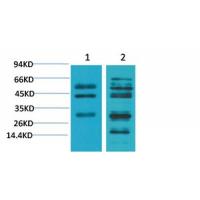 TGFβ1 Polyclonal Antibody