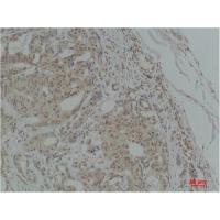 TGFβ1 Polyclonal Antibody