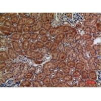 Frizzled-10 Polyclonal Antibody