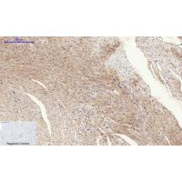 Tau Polyclonal Antibody