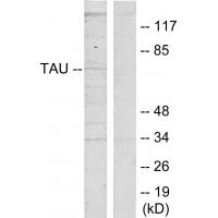 Tau Polyclonal Antibody