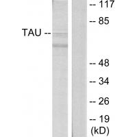 Tau Polyclonal Antibody