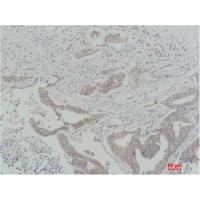 Raf-1 Polyclonal Antibody