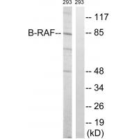 Raf-B Polyclonal Antibody