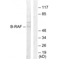 Raf-B Polyclonal Antibody