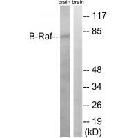 Raf-B Polyclonal Antibody