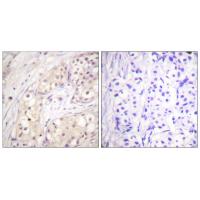 Raf-B Polyclonal Antibody