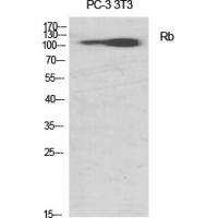 Rb Polyclonal Antibody