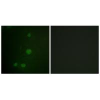 Rb Polyclonal Antibody