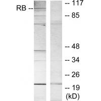 Rb Polyclonal Antibody