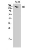 Rb Polyclonal Antibody