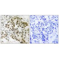 Rb Polyclonal Antibody