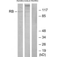 Rb Polyclonal Antibody