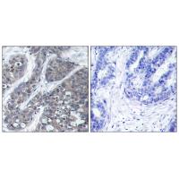 PYK2 Polyclonal Antibody