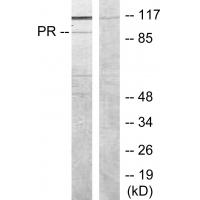 PR Polyclonal Antibody