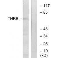 Prothrombin Polyclonal Antibody