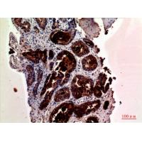 PSA Polyclonal Antibody