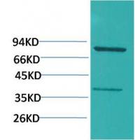 PI3 Kinase p85α Polyclonal Antibody