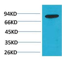 PI3 Kinase p85β Polyclonal Antibody