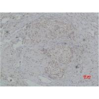 PI3 Kinase p85β Polyclonal Antibody