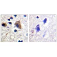 PIP5KIII Polyclonal Antibody