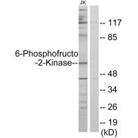 PFK-2 car Polyclonal Antibody