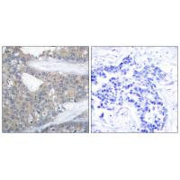 Paxillin Polyclonal Antibody