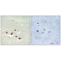 Pdcd-4 Polyclonal Antibody