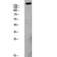 PDGFR-α Polyclonal Antibody