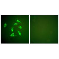 PDGFR-α Polyclonal Antibody