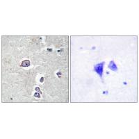 PDGFR-α Polyclonal Antibody