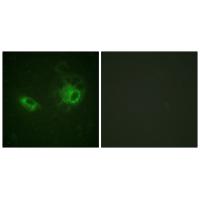 PDGFR-β Polyclonal Antibody