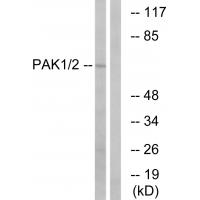 PAKα Polyclonal Antibody