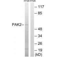 PAKγ Polyclonal Antibody