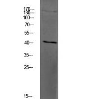 PAR4 Polyclonal Antibody