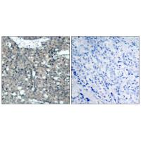 Paxillin Polyclonal Antibody