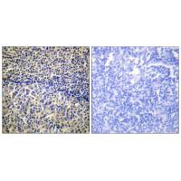 p47-phox Polyclonal Antibody