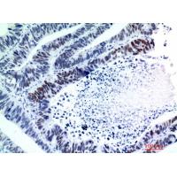 p53 Polyclonal Antibody