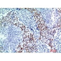 p53 Polyclonal Antibody