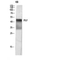 p57 Polyclonal Antibody