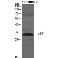 p57 Polyclonal Antibody