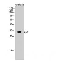 p57 Polyclonal Antibody